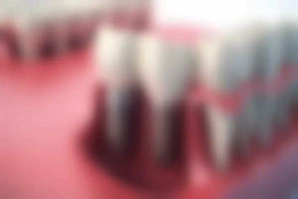超值优惠！吴忠西典口腔医院牙齿矫正费用仅需6800元起，原价8000元起。