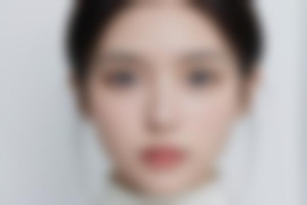郑州于艳菊胎记疤痕修复绝了！40年临床专治疑难皮肤问题
