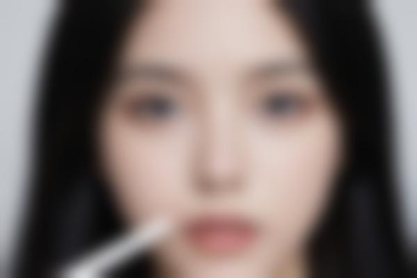 郑州张秀英医生整形技术好吗？张秀英医生隆鼻双眼皮自然风价格亲民！