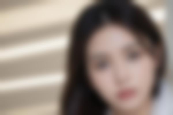 2、吕辉馒化修复技术精细自然