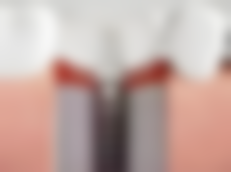 深圳麦芽口腔医院匠心种植技术解析