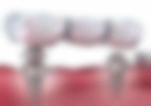 四、重庆陈刚口腔设备介绍