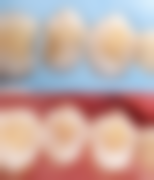 一、河南郑州新密益呀口腔怎么样