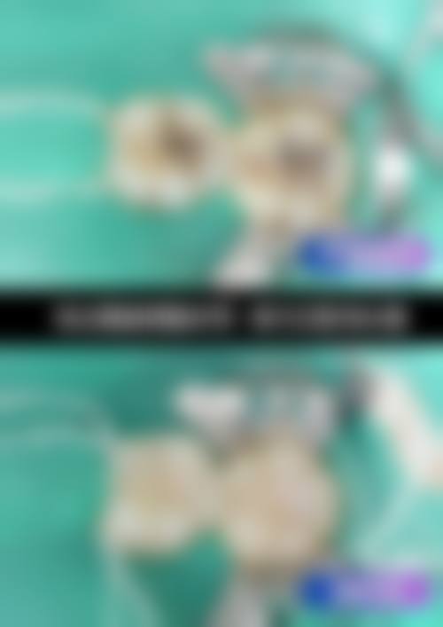 三、临沂兰山惠娟口腔诊所核心科室与特色项目