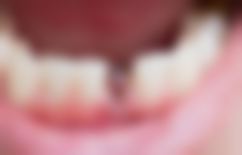 四、西安雁塔寨西海涛口腔门诊部设备介绍