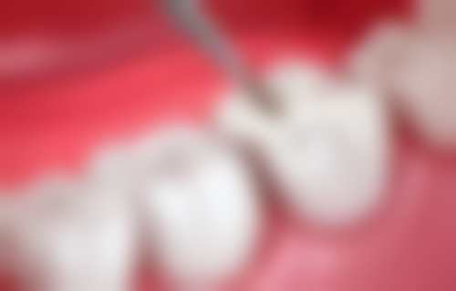 二、深圳凯莱口腔诊所医生团队，打造专精诊疗服务