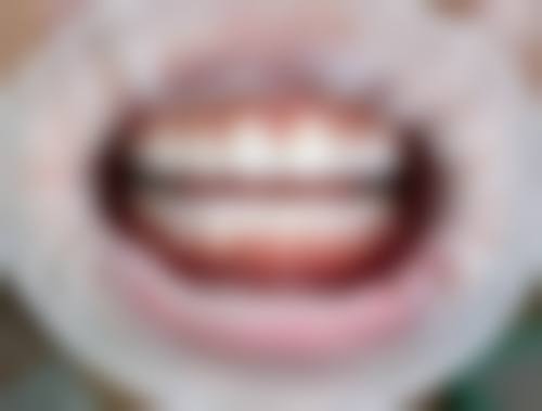 四、北京冠美口腔医院设备介绍