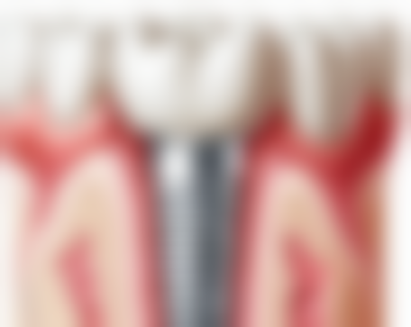 四、武汉市中医医院口腔科设备介绍