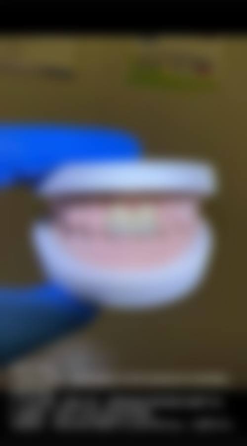 四、荆州石首大众楚星口腔门诊部设备介绍