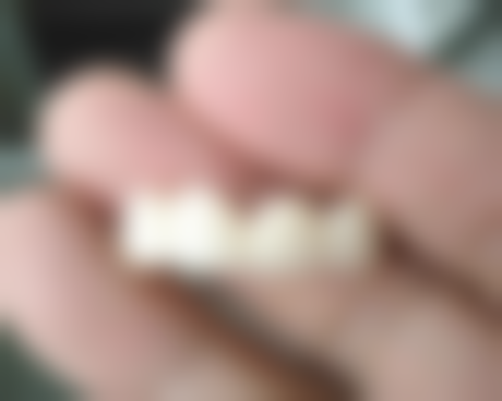 七、深圳郭悦龙口腔就医指南,便捷就诊不迷路