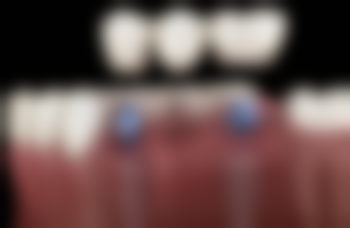 四、湖北恩施利川彭利平口腔设备介绍