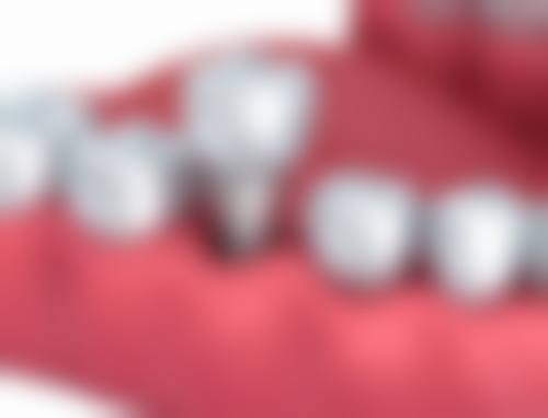 三、中山市郑刘卫劲口腔核心科室与特色项目