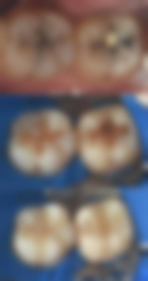 二、江苏南京江宁英诺口腔医生团队，打造专精诊疗服务