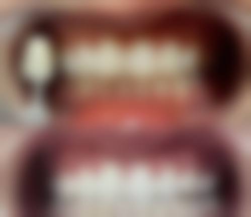 六、韩国艺颂嗓音中 心医院荣誉资质与患者口碑，见证品牌实力