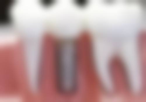 六、广东肇庆禄步雅斯美口腔诊所荣誉资质与患者口碑，见证品牌实力