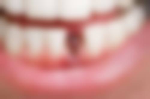 七、山东威海乳山玖舵口腔就医指南，便捷就诊不迷路