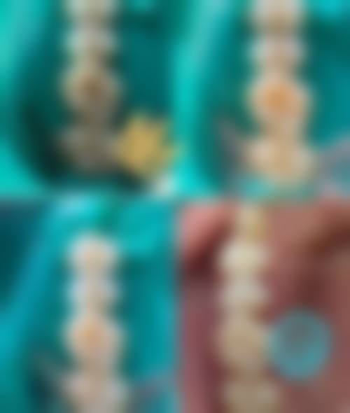 二、山东威海乳山玖舵口腔医生团队，打造专精诊疗服务