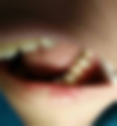 二、广东惠州牙洁仕口腔医生团队，打造专精诊疗服务