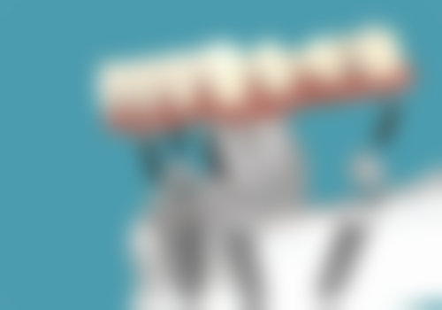 四、长阳龙舟坪宏远口腔诊所设备介绍