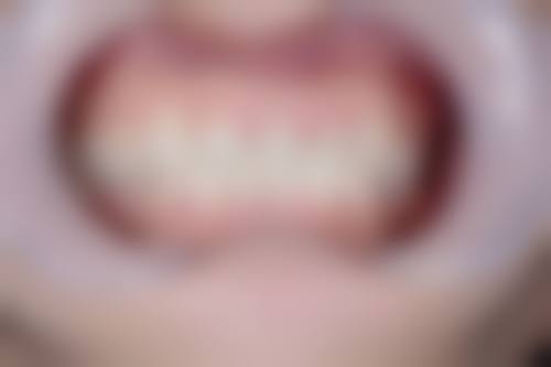 四、烟台莱州仁爱口腔设备介绍