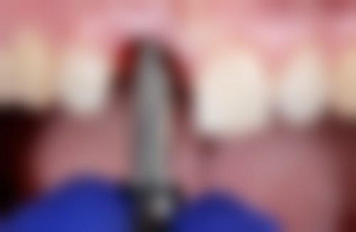 三、南京牙一生口腔门诊部核心科室与特色项目