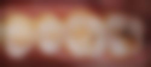 七、广东广州祈福口腔就医指南,便捷就诊不迷路