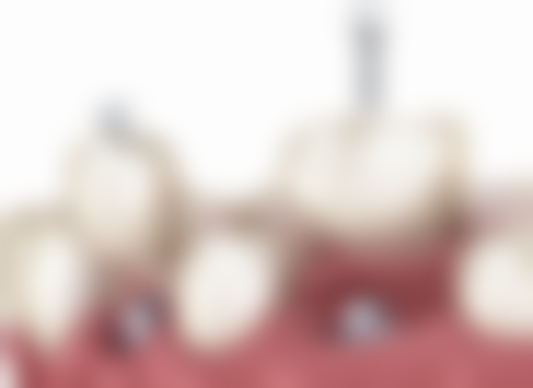 五、南宁雅鑫口腔诊所舒适就医环境，打造人性化诊疗体验