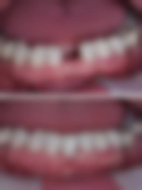 四、南京江宁琳容口腔设备介绍