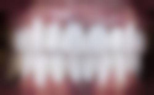 六、深圳华悦口腔门诊部荣誉资质与患者口碑,见证品牌实力