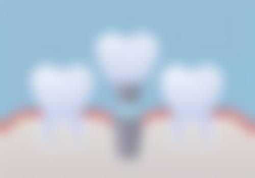 二、四川成都锦江极光口腔医生团队，打造专精诊疗服务