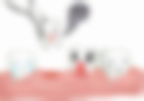 七、镇雄龈晔口腔门诊部就医指南，便捷就诊不迷路