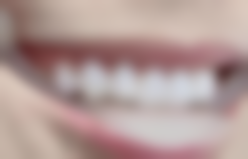 四、湖北咸宁通山康泰医院设备介绍