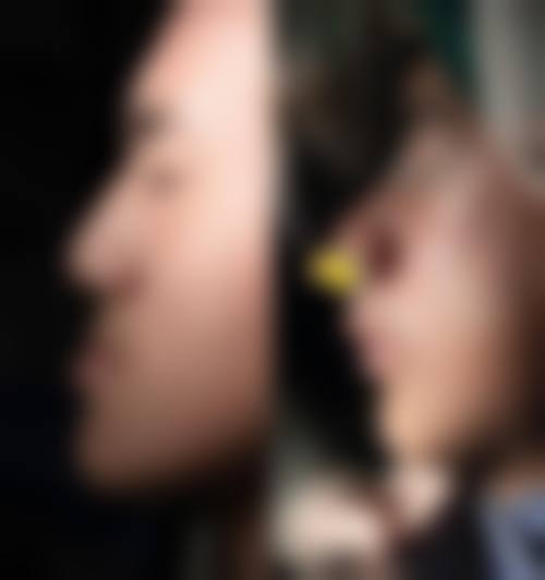 七、深圳雅美天使口腔诊所就医指南，便捷就诊不迷路