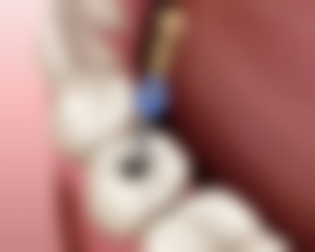 七、湖北咸宁通山康泰医院就医指南，便捷就诊不迷路