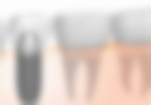 四、重庆奥泰口腔诊所云清路店设备介绍