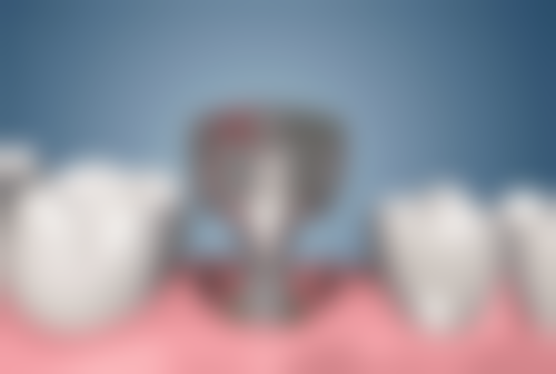 三、重庆奥泰口腔诊所云清路店核心科室与特色项目