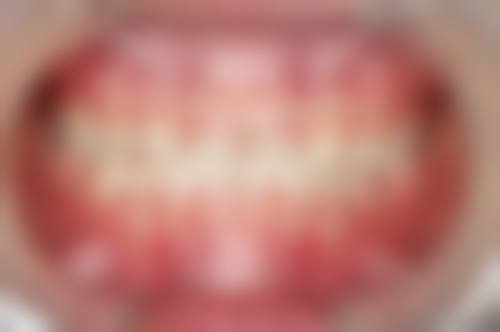 七、湖南永州宁远好牙医口腔就医指南，便捷就诊不迷路