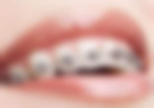 七、浙江宁波慈溪徐建忠口腔诊所就医指南,便捷就诊不迷路