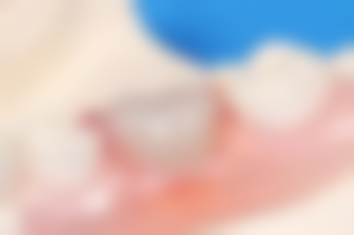 二、广东惠州翊登口腔门诊部医生团队，打造专精诊疗服务