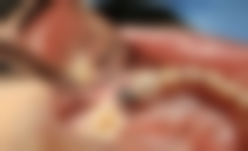 六、中山黄圃松鼠口腔医院荣誉资质与患者口碑,见证品牌实力