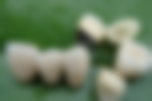 四、江苏苏州马增军口腔设备介绍