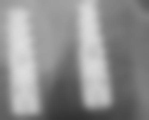 七、深圳博耀齿科(盐田分院)就医指南，便捷就诊不迷路