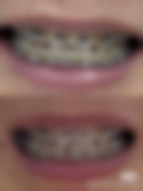 三、杭州富阳添齿口腔核心科室与特色项目