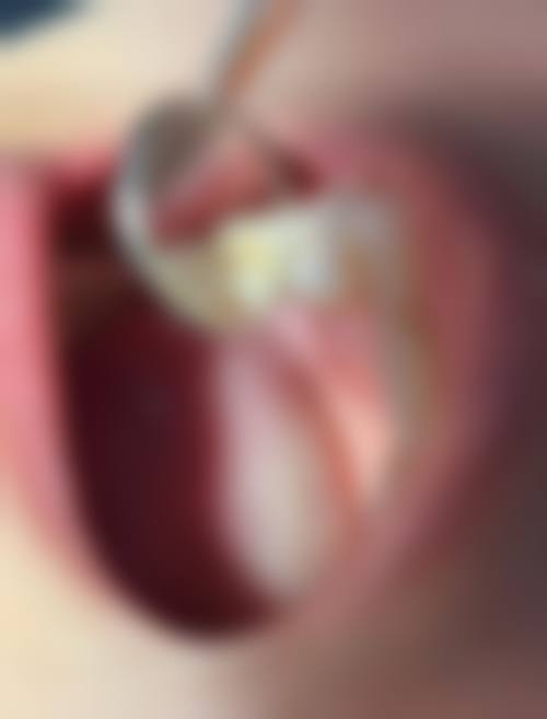 七、吴江盛浙口腔门诊部就医指南，便捷就诊不迷路