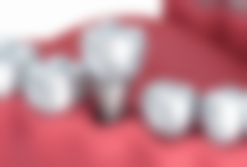 七、深圳萬豐醫院口腔科就医指南，便捷就诊不迷路