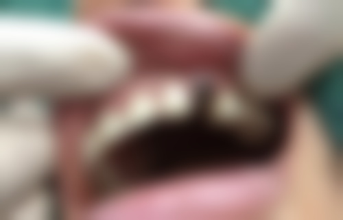 三、青岛志正口腔(天一仁和店)核心科室与特色项目