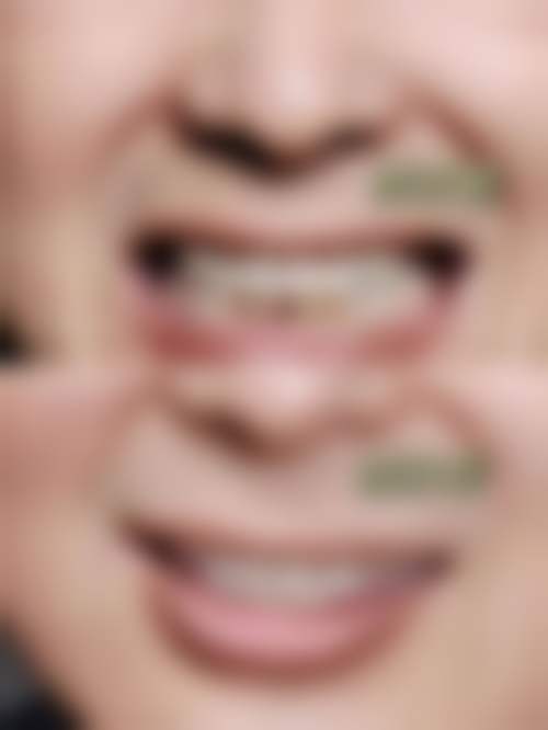 二、深圳柏齿康口腔医生团队,打造专精诊疗服务