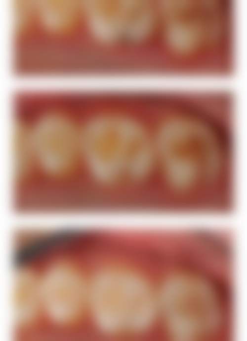 四、深圳柏齿康口腔设备介绍