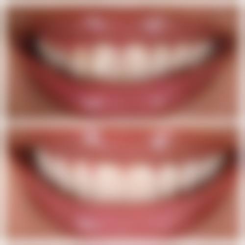 六、北京维尔口腔荣誉资质与患者口碑，见证品牌实力