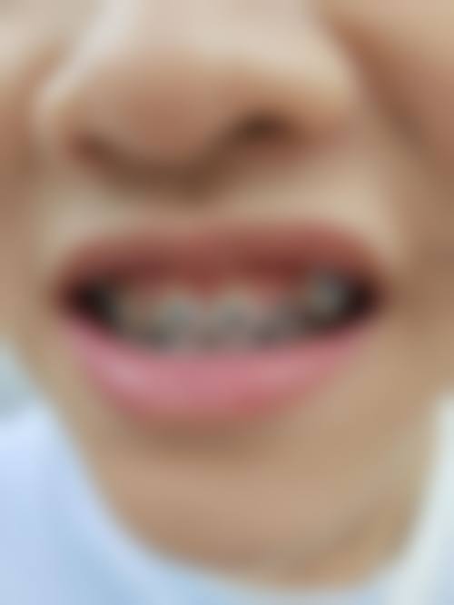 五、广东深圳御齿口腔舒适就医环境,打造人性化诊疗体验